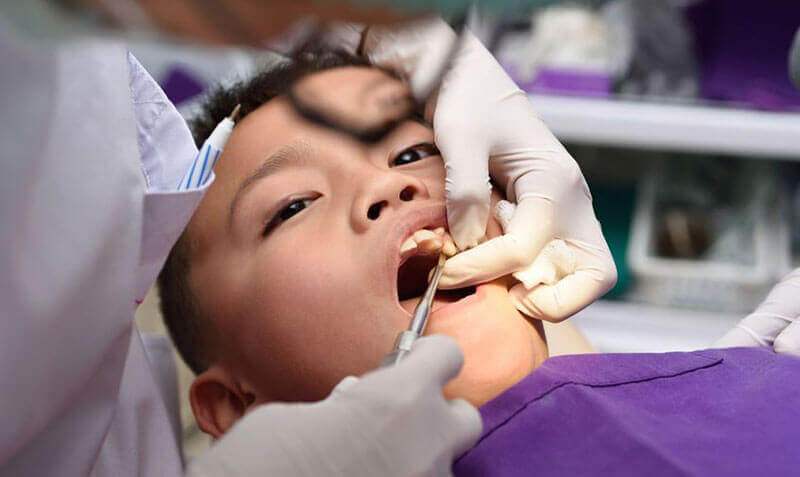 Tooth Extractions St. Albert